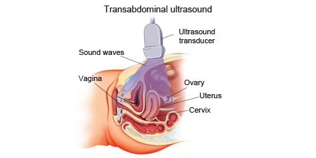 ultrasound-2