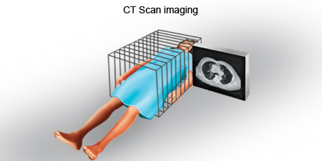 CT-scan-2