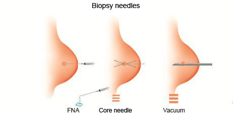 Biospy Needles